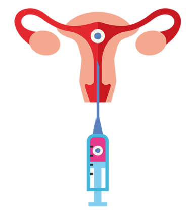 inseminacao inseminacao